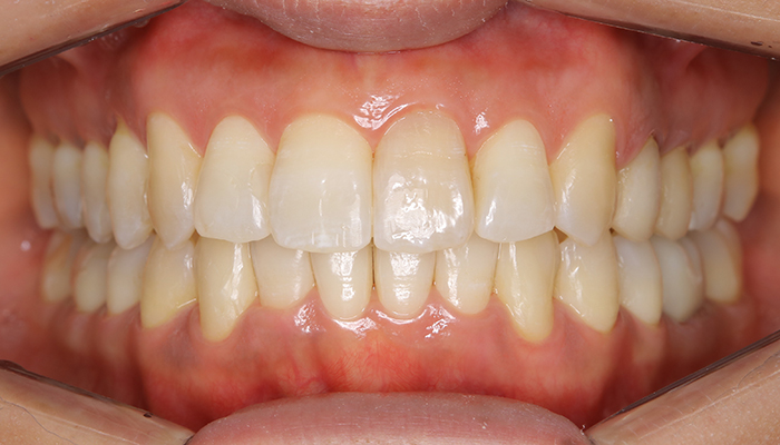 After