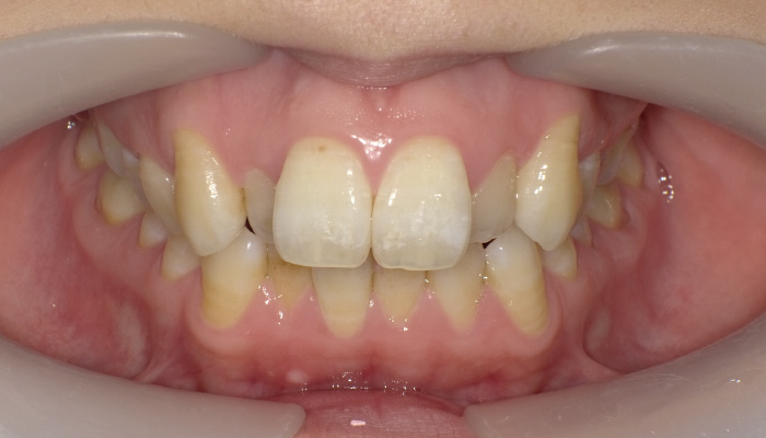 Before