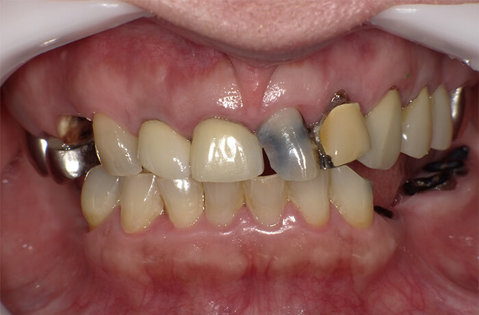 Before