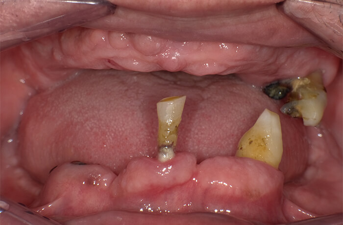 Before