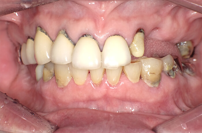 Before